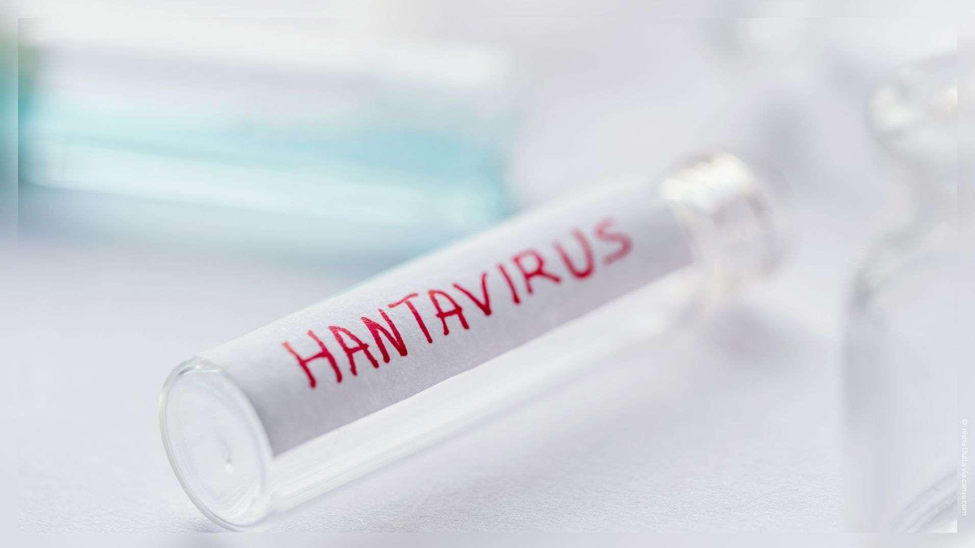 Hantavirus : "Nous sommes très loin de la situation du Covid", rassure le Dr Ali Mofredj sur Maritima